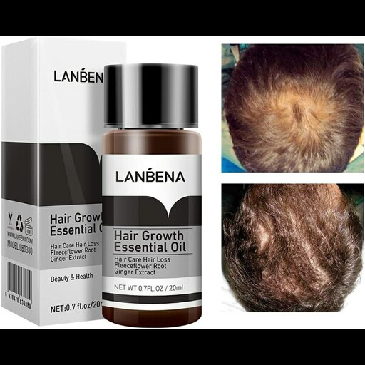 سرم رشد و تقویت مو لانبنا (lanbena)


