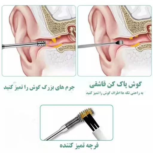 گوش پاک کن مدل F85 بسته 6 عددی