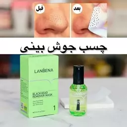 چسب بینی لانبنا لاکی ضد جوش سرسیاه (آرایشی هوتران)