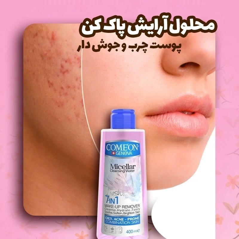 محلول آرایش پاک کن صورت کامان ComeOn میسلار واتر Micellar  مناسب پوست چرب و جوش دار و حساس  حجم  400 میل