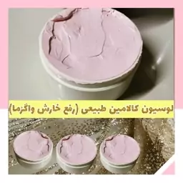 لوسیون کالامین طبیعی (کرم ضد خارش و رفع اگزما) 50 گرمی