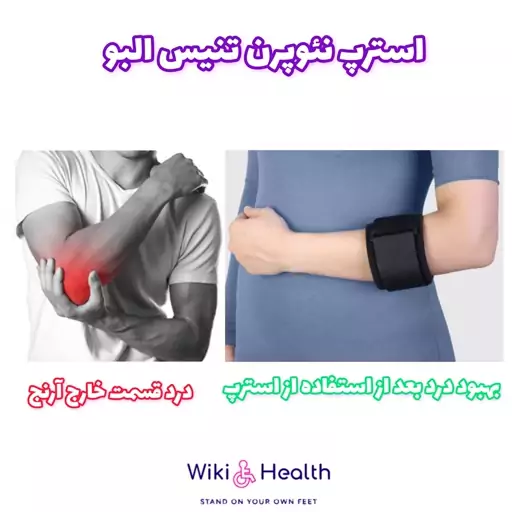 استرپ نئوپرن تنیس البو  (طب و صنعت) (ویکی هلث)