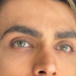 لنز  چشم  رنگی فصلی طبی (نمره دار) مارک دهب رنگ نچرال گرین