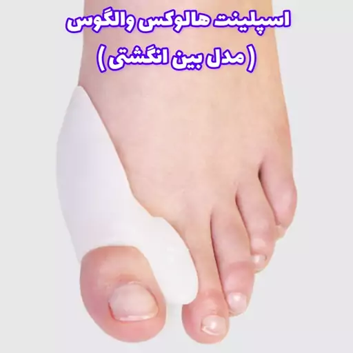 اسپلینت هالوکس والگوس(مدل بین انگشتی) (طب و صنعت) (ویکی هلث)