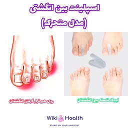 لا انگشتی سیلیکونی Silicone Toe Separators (فاصله دهنده انگشت ) (طب و صنعت) (ویکی هلث)