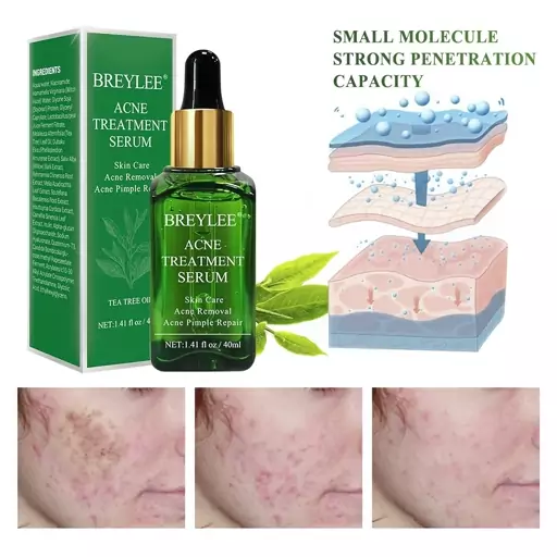 سرم  ضد جوش قوی چای سبز  بریلی  BREYLEE Acne Treatment Serum Tea Tree