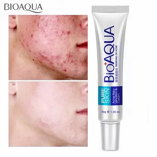 کرم ضد جوش بیوآکوا کرم ضد جوش و  ضد آکنه بیوآکوا ا Bioaqua anti-acne cream