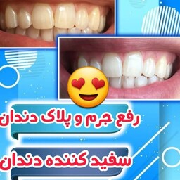 پودرسفیدکننده دندان