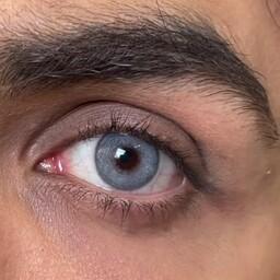 لنز چشم رنگی فصلی طبی (نمره دار) مارک دهب رنگ نچرال بلو