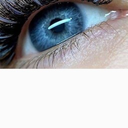 لنز رنگی چشم 