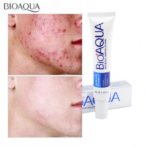 کرم تیوپی درمانی ضد جوش و آکنه اورژانسی بیوآکوا BIOAQUA REMOVAL OF ACNE CREA
کرم ضد جوش بیوآکوا کرم فوری ضدجوش