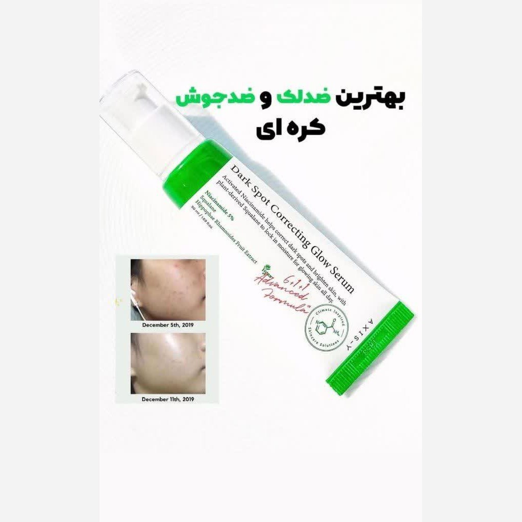 کرم ضدلک اکسیس وای 