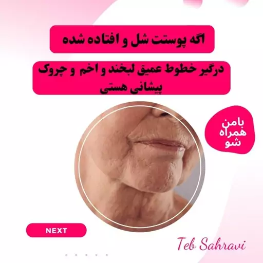 کرم لیفتینگ صورت و گردن