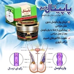 پماد گیاهی ضد واریکوسل