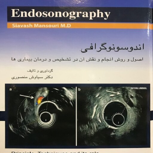 کتاب اندوسونوگرافی Endosonography  اصول و روش انجام نقش آن در تشخیص و درمان بیماری ها