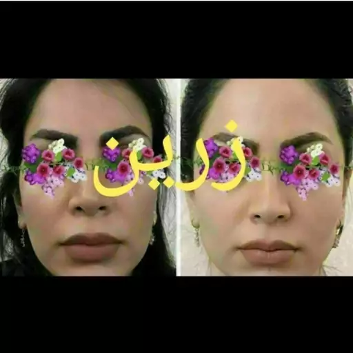 پک کامل گونه گذار  زرین 