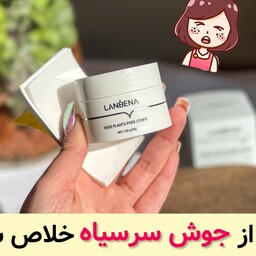 چسب بینی ضد جوش سر سیاه لانبنا 