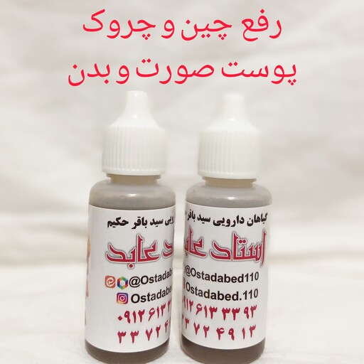 گیاهان سید باقر حکیم ( استاد عابد ) رفع چین و چروک پوست صورت و بدن