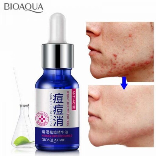 سرم ضد جوش اورژانسی bioaqua