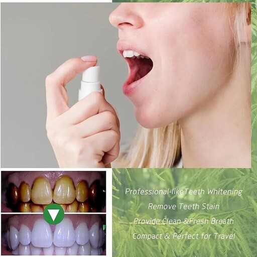 دندان  اسپری تمیز کننده دهان و دندان، اسپری دهانی روشن کننده دندان، پاک کننده قوی لکه، حفظ سلامت دندان ها و لثه ها