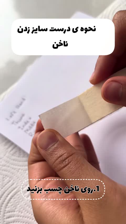 کاشت موقت دستساز دارک کروم