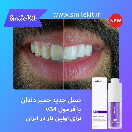 خمیر دندان سفید کننده اسمایل کیت  smilekit با فناوری v34 (اصل)(پیشنهادی)