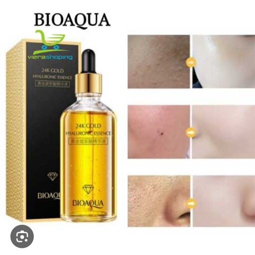 سرم آبرسان ضد جوش و لک طلا بیوآکوا BIOAQUA

