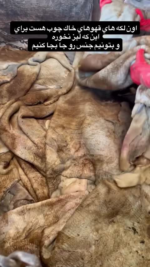 کفش طبی زنانه چرم طبیعی گارانتی دار از چرم انتخاب