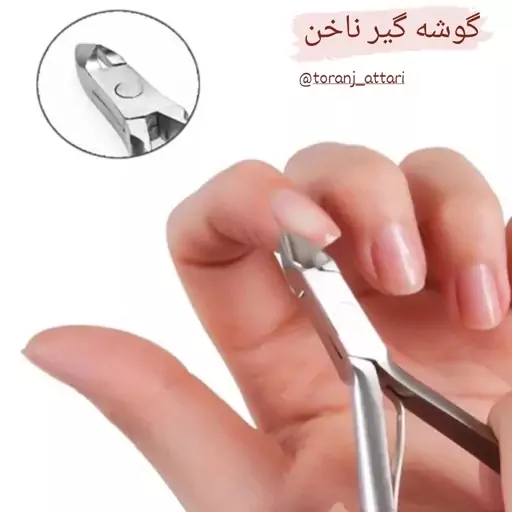 گوشه گیر ناخن ترنج