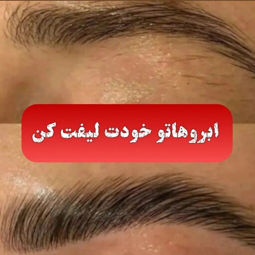 ژل لیفت ابرو