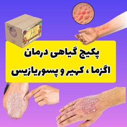 پک اگزما کهیر و پسوریازیس