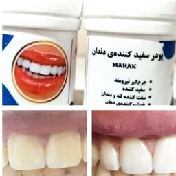 سفید کننده دندان ماهک (گیاهی -رفع لکه ناشی از قهوه و سیگار و بوی بد دهان)