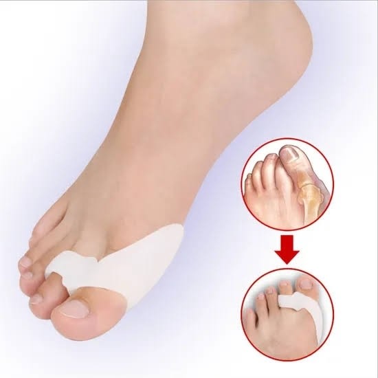 فاصله دهنده سیلیکونی ساپورت دار انگشت شست (اقساط)