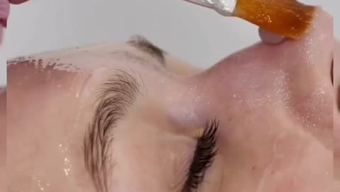 ژل آبرسان و سوتینگ گریبرد تسکین دهنده التهاب