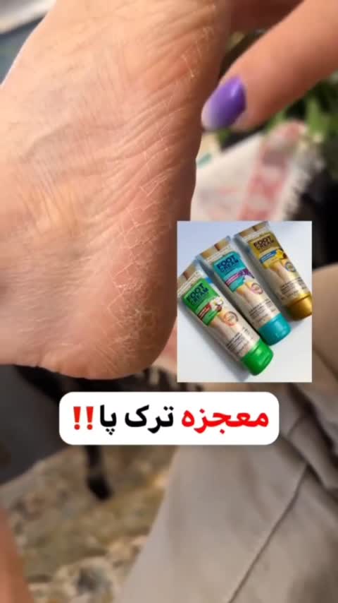 کرم ضد ترک و خشکی پا اورجینال(ارسال رندوم)