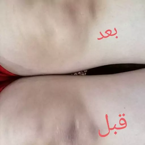 ماسک اسکراب روشن کننده الورا