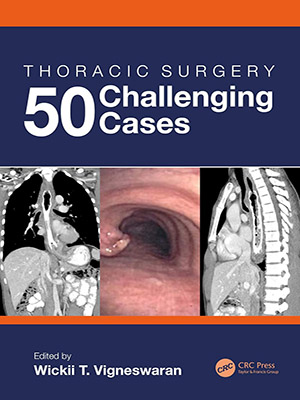 دانلود کتاب Thoracic Surgery: 50 Challenging Cases
