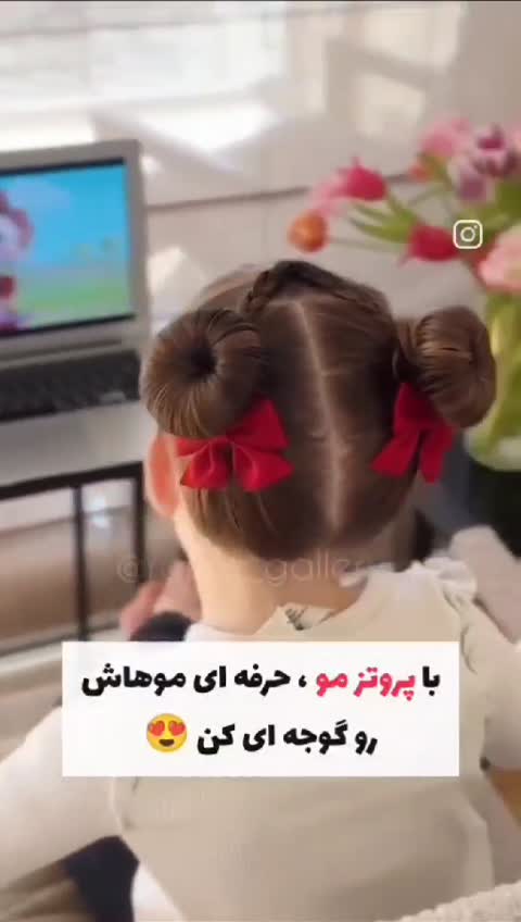 پروتز مو یا هات باز سایز بزرگ 