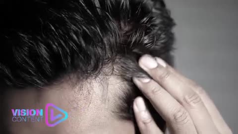 شامپو ضد ریزش دژن 750 میل