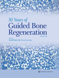 خرید و دانلود نسخه کامل کتاب 30 Years of Guided Bone Regeneration (3rd Edition) – Pdf