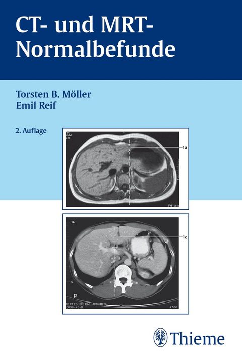 خرید و دانلود نسخه کامل کتاب CT und MRT Normalbefunde – Pdf