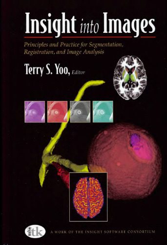 خرید و دانلود نسخه کامل کتاب Insight into images: principles and practice for segmentation  registration  and image anal
