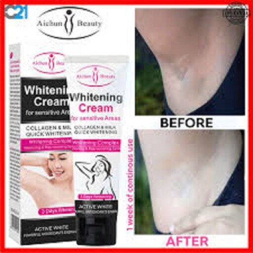 کرم سفید کننده نواحی خاص آیچون بیوتی مدل Whitening Cream (حجم 50 میل)