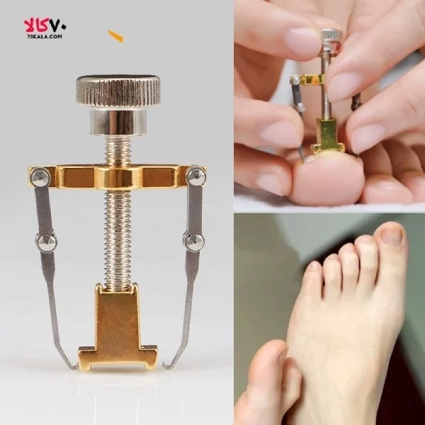 ارتودنسی ناخن اصلاح ناخن
