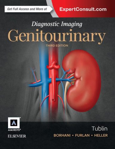 خرید و دانلود نسخه کامل کتاب Diagnostic Imaging Genitourinary فایل مجازی و دانلودی