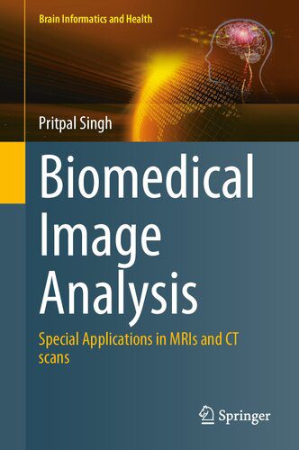 خرید و دانلود نسخه کامل کتاب Biomedical Image Analysis: Special Applications in MRIs and CT scans فایل مجازی و دانلودی