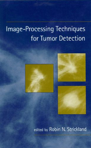 خرید و دانلود نسخه کامل کتاب Image-Processing Techniques for Tumor Detection فایل مجازی و دانلودی