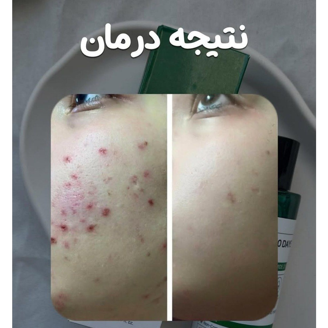 تونر میراکل ضدجوش روشن کننده سام بای می