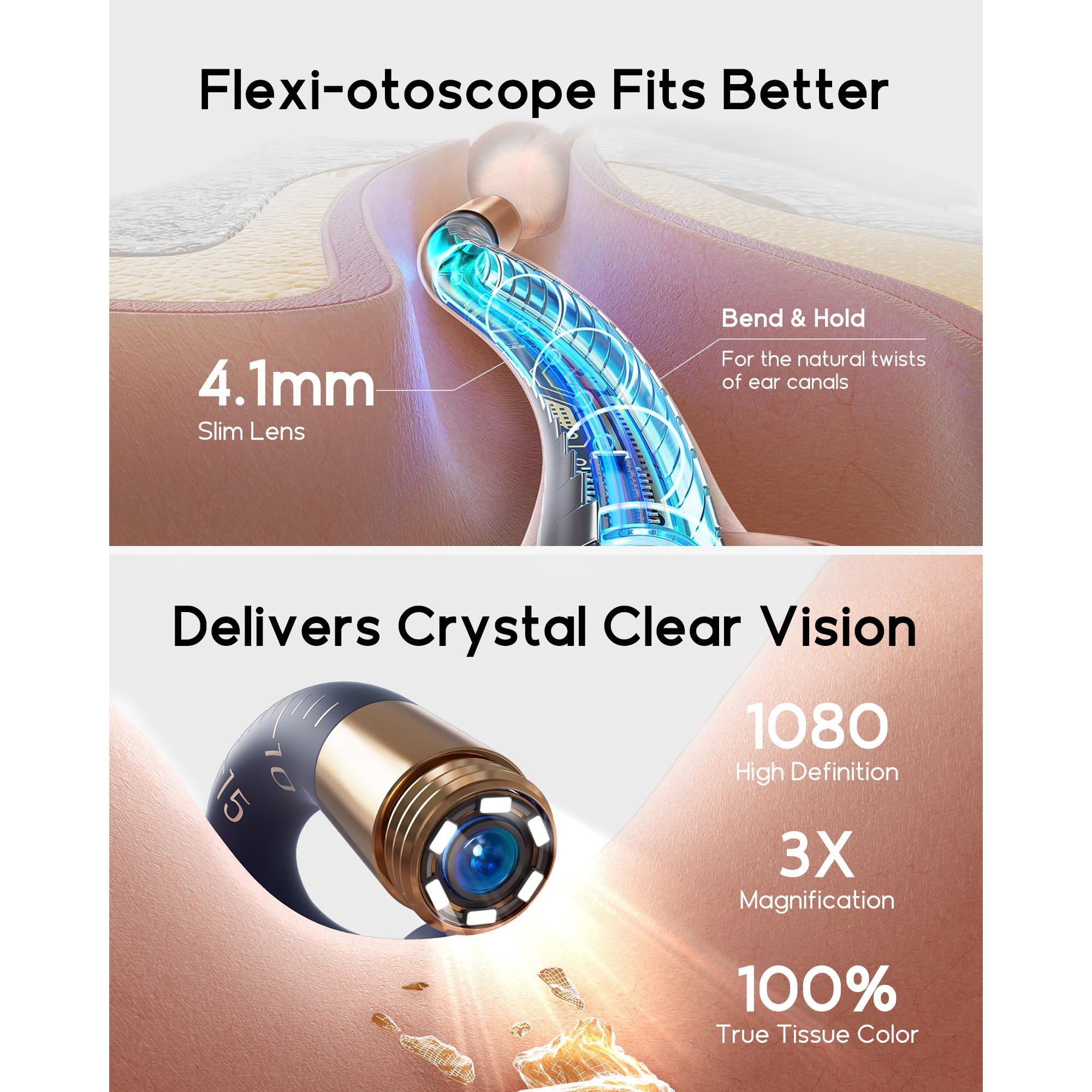 گوش پاک کن هوشمند دوربین دار Bebird EarSight Plus I35R