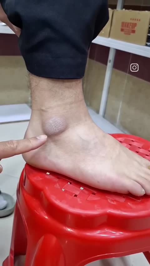 اسپری پینه بردار راکو 